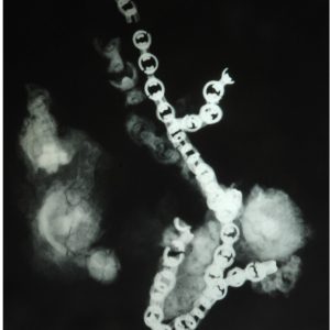 27-Morso-ferro e bronzo-radiografia di una parte-catenella