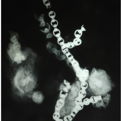 27-Morso-ferro e bronzo-radiografia di una parte-catenella